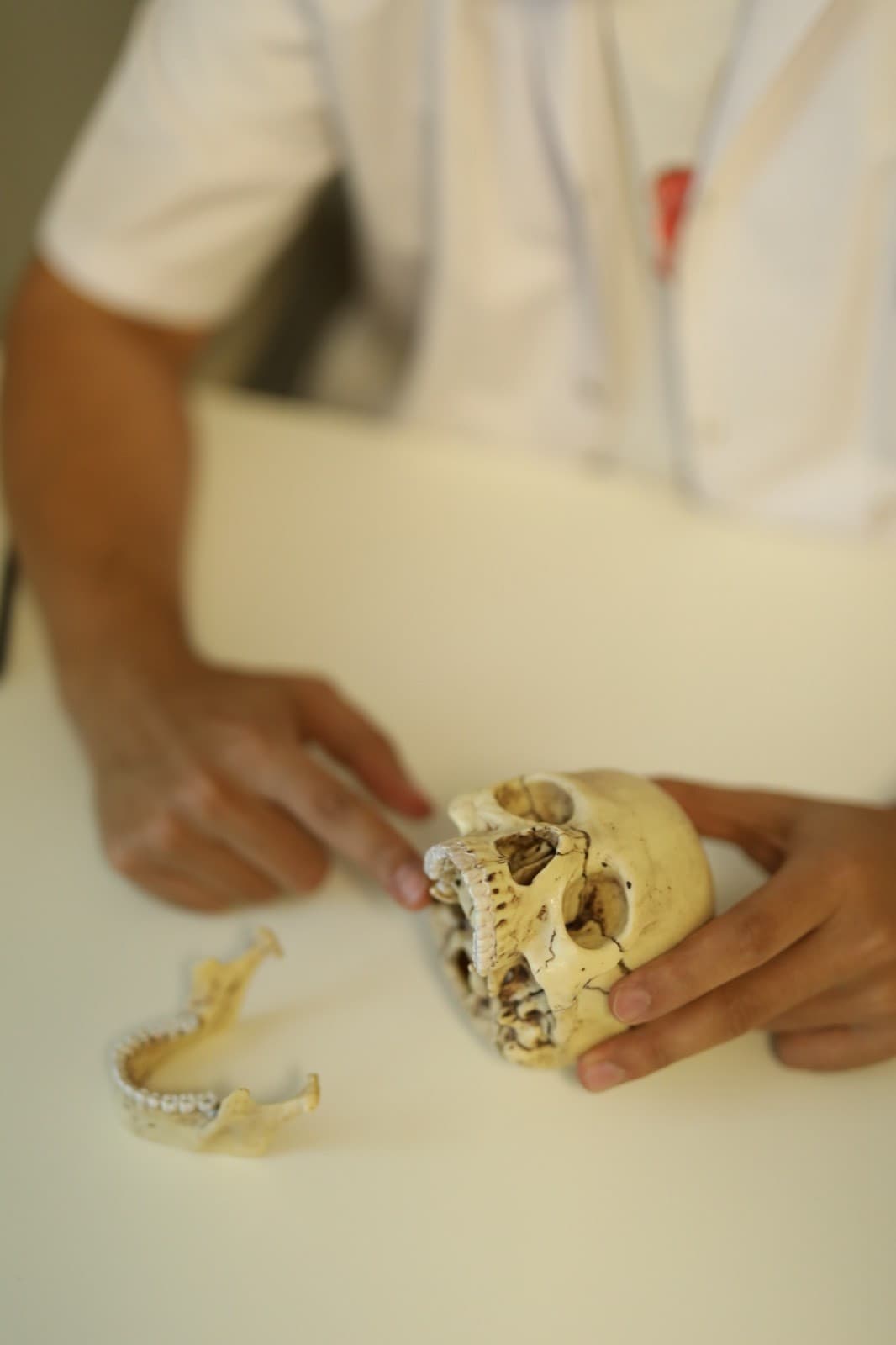 TMJ – Jaw Joint Rehabilitation