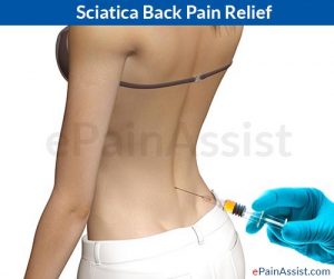 https://izmirfizyoterapi.com/wp-content/uploads/2020/02/Sciatica-Back-Pain-Relief.jpg