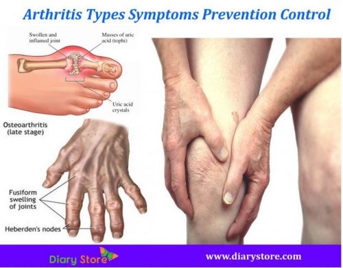 https://izmirfizyoterapi.com/wp-content/uploads/2020/02/arthritis_types_symptoms_prevention_control-min.jpg